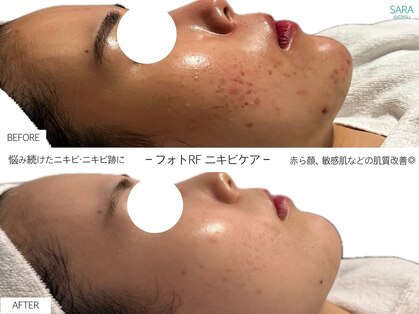 サラ 恵比寿店(SARA)の写真