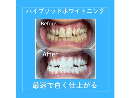 シャイニング 岩出店(SHINING)の写真
