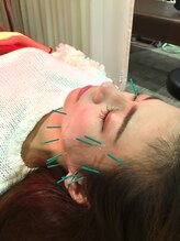 しみず鍼灸接骨院/美容鍼&美顔鍼