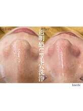 ルククギフ 岐阜(〇△□rukuku)/毛穴洗浄