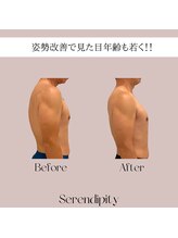 セレンディピティー(Serendipity)/【猫背/姿勢改善ケア】