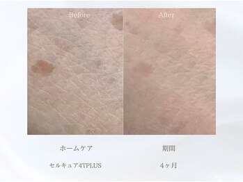 ベレガ 大阪本店(BELEGA)/ビフォーアフター