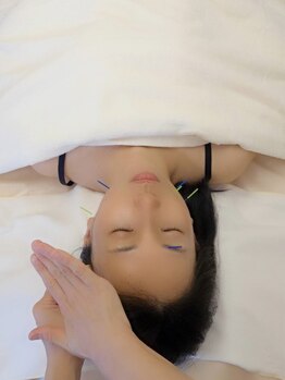 ハリ ヴァカンス(Hari Vacances)の写真/忙しい日常を忘れリラックス！鍼灸師歴14年の実力派が贈る、リフトアップ体験で美しく輝くあなたに♪