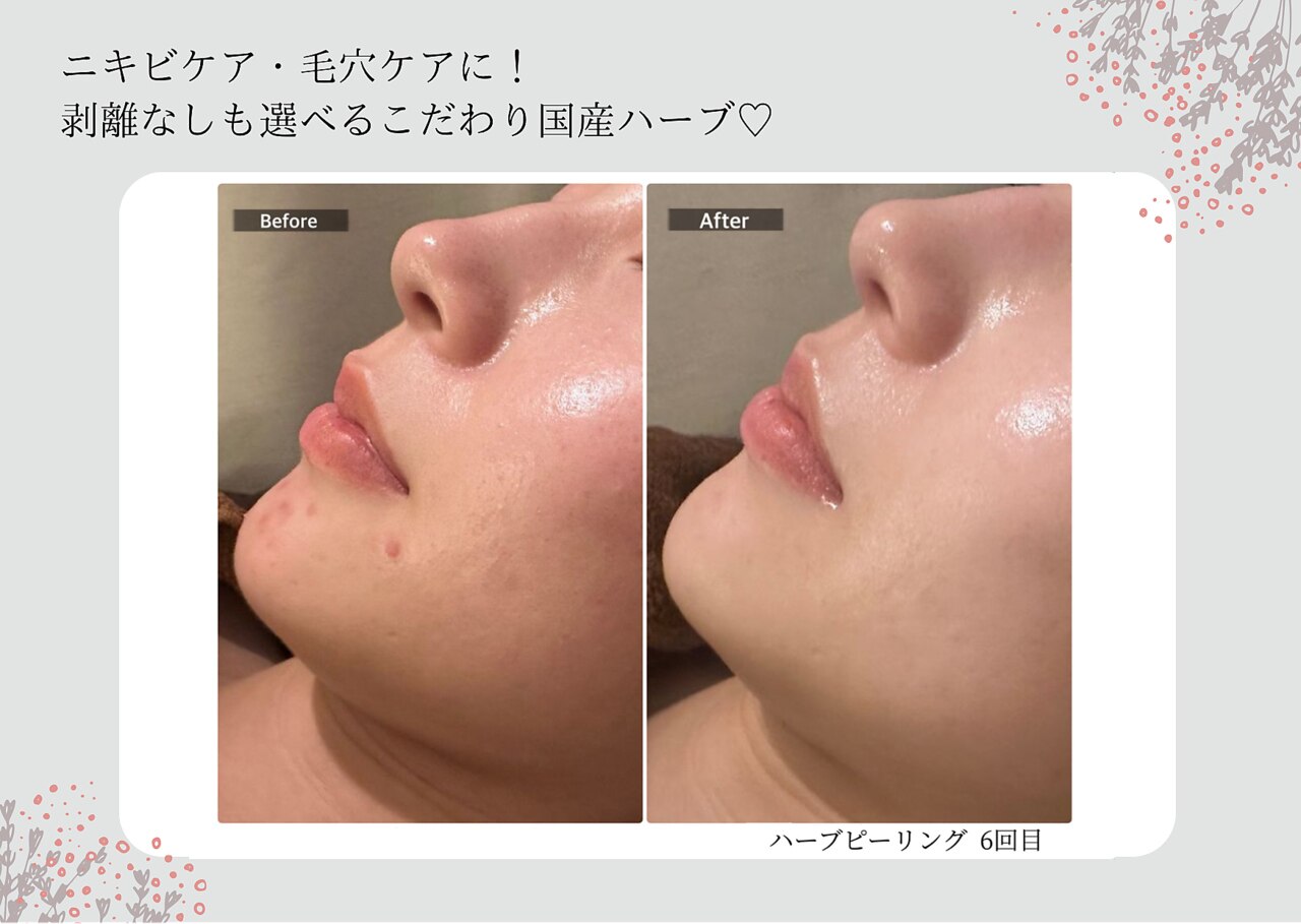 エミルカ 宮崎店(EMILUCA)｜ホットペッパービューティー