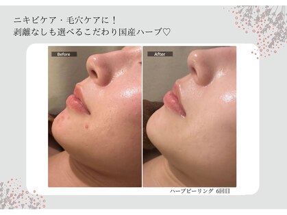 エミルカ 宮崎店(EMILUCA)の写真