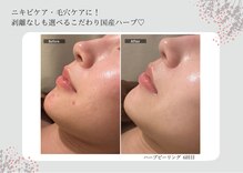 エミルカ 宮崎店(EMILUCA)