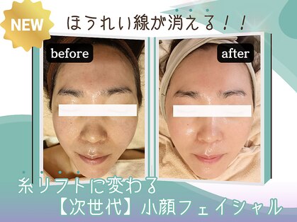 キザシ(kizashi)の写真