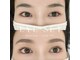 アトリーチェ(ATTRICE)の写真