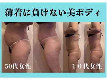 ルナ(Luna)の写真/効果に満足の全身痩身！！夏応援体験【全身痩身￥10,000】