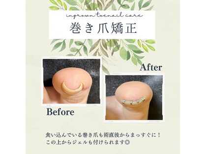 凜花の写真