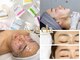 カエラ(Caela)の写真/【肌が綺麗になるフェイスWAX】脱毛しながら肌質改善が叶う♪肌トーンUP・化粧ノリUPの美肌へ導きます◎