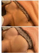 美人バスト 浜松店/◆バストアップ &nbsp;BeforeAfter◆