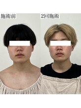 ヴェルシック(Belchic)/輪郭が変われば印象も変わる