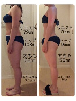 ホロニック ベルサンテ(Holonic Belle Sante)/メディセルハイブリッド