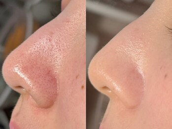 ルーナジェーナ(Luna llena)/