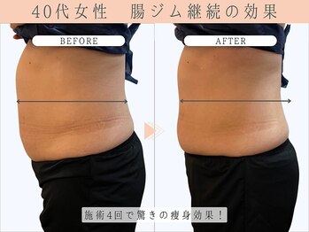 那賀洋子式 顔ジム 大分戸次店/腸ジム4回の効果