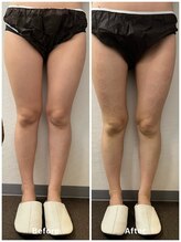 ルミナス/CAVI -CRYO PRO の凄さ！