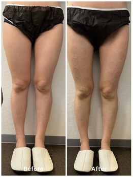 ルミナス/CAVI -CRYO PRO の凄さ！