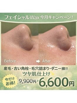 エレナ(Elena)の写真/4月限定価格！大人気の艶肌フェイシャルWaxを9,900円→6,600円特別価格にてクーポン発行中☆