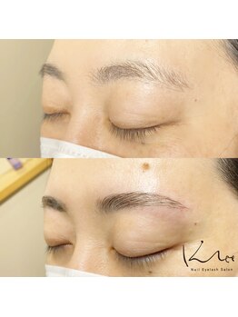 クレー(Klee)/アイブロウリフト