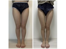 オンケイ(Onkei)/９０分　足両面×７回