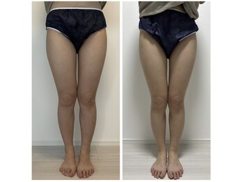 オンケイ(Onkei)/90分 足両面×7回