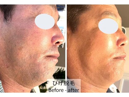 ひかり素肌の写真