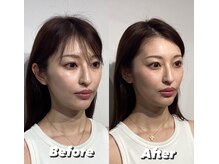 コルミチョン サロン(骨美整 salon)/Before・After