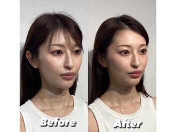 コルミチョン サロン(骨美整 salon)/Before・After