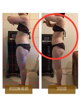 サロンドボーテ ヴィクトワール マルヤマ(Salon de beaute VICTOIRE MARUYAMA)/フォースカッター【w1ペース】