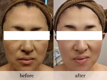 ワールドビューティー(World Beauty)の雰囲気（【ADS肌改善プログラム１年】 シミ・肌改善はお任せ下さい。）
