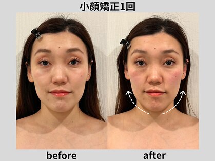 ビトリア 横浜店(BITORIA)の写真