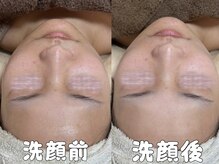 グラシア 倉敷店(Gracia)/REVIホームケア商品の泡洗顔