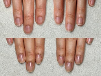 ネイル アンチュプラス(Nail Anchu+)の写真/コンプレックス爪/トラブル爪/深爪/ちび爪など、爪のお悩みを改善◎褒められ美爪が叶うサロン♪