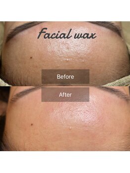 ミベレ 八王子(Mebere)/艶肌！！フェイスワックス