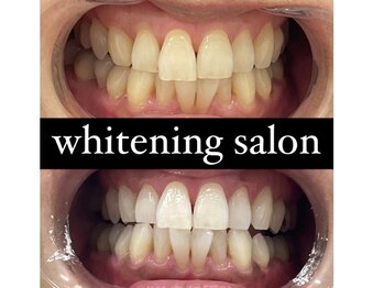 チェルト 鈴鹿店(CERTO)/歯のホワイトニング