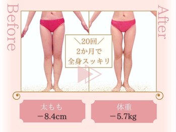 ピュアエステ ブリアント 新宿店/お客様の結果［新宿/痩身］