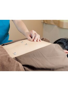 鍼灸施術を受けたい