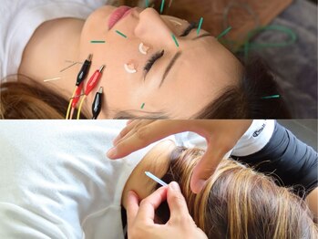 ワンドア(ONEDOOR)の写真/【首肩スッキリ&電気を流す美容鍼】お顔&首肩コリもスッキリ★【初回135分/プレミアム美容+首肩鍼◎¥8500】