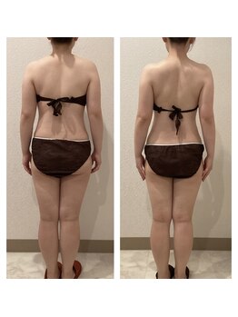 ボーテ(beaute)/【ビフォーアフター】