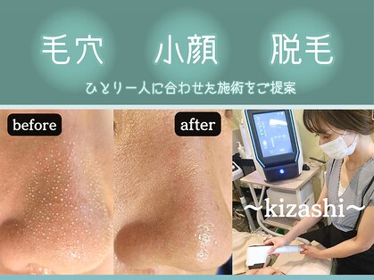 キザシ(kizashi)の写真