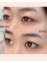 プリティアイ(pretty eye)/逆さまつげも解消出来ます。