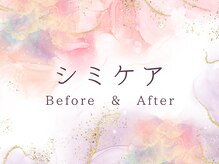 ココロ(COCORO)/シミケア