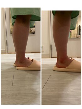 このか/施術後に整った足首の変化
