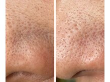 サイ(Sai)/before⇒after