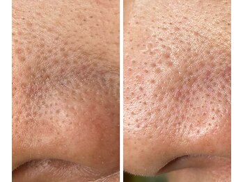 サイ(Sai)/before⇒after