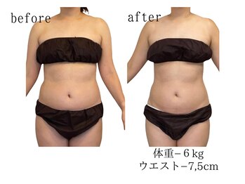 ココロミ(cocoromi)/ハイパーナイフ