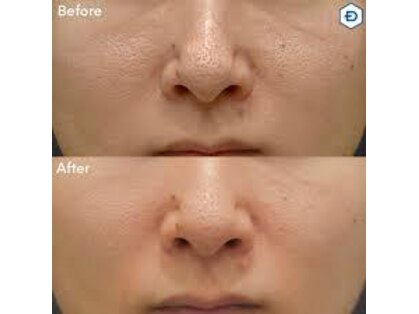 ウェルビーイング(well-being)の写真