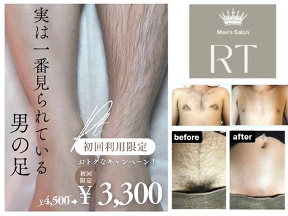 アールティー(RT)の写真