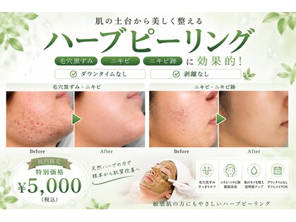 毛穴専科の写真